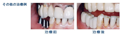 その他の治療例1