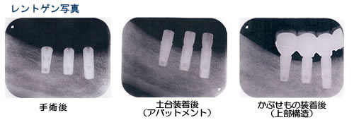 その他の治療例2