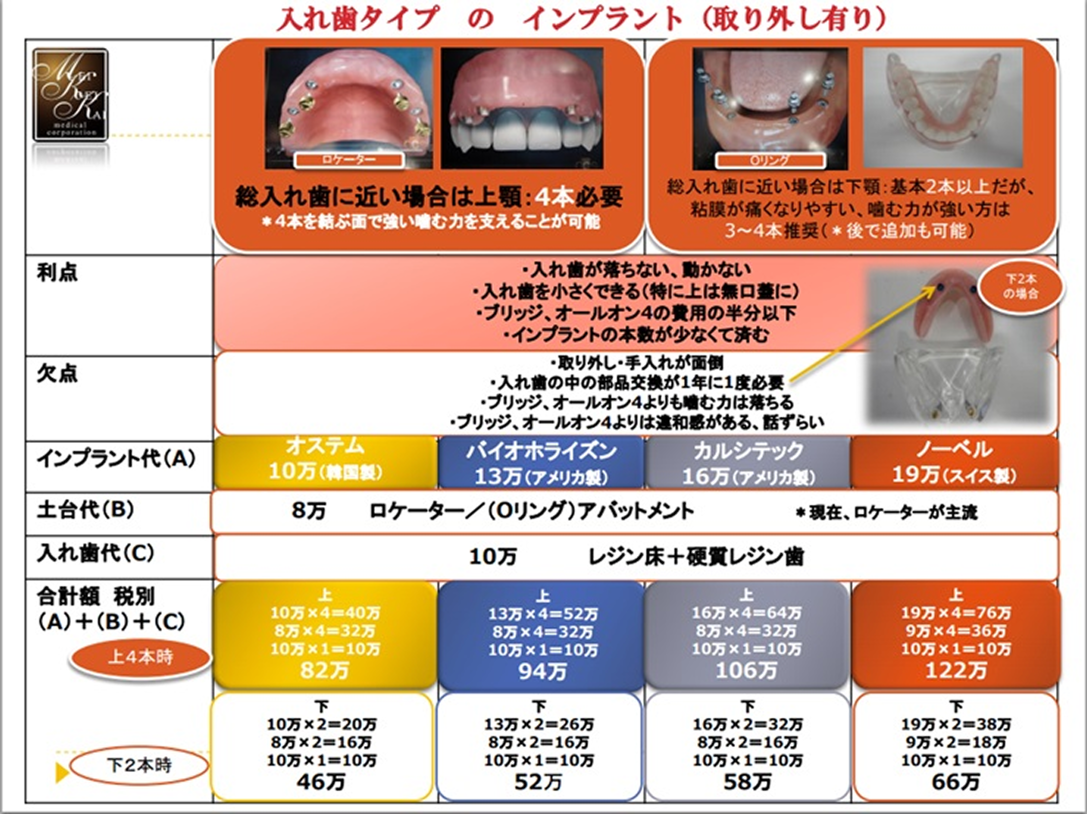 義歯治療（部分入れ歯・総入れ歯）