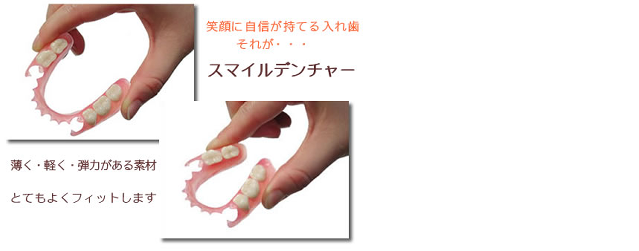 スマイルデンチャー（バネのない入れ歯）