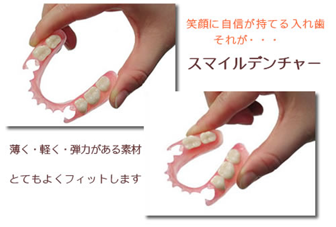 スマイルデンチャー（バネのない入れ歯）