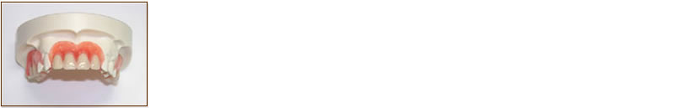 スマイルデンチャーの治療費