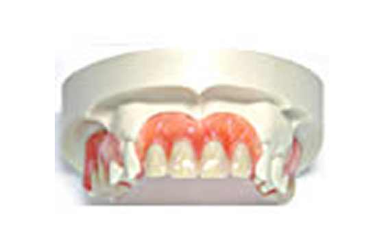 スマイルデンチャー