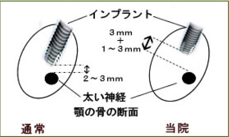 出血・神経マヒ対策が不十分