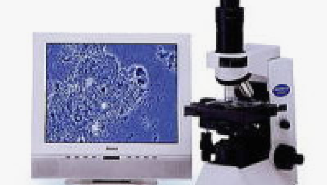 位相差顕微鏡検査