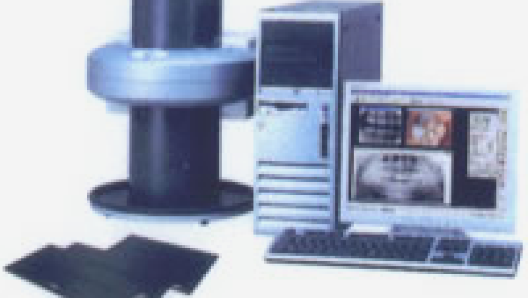 デジタルレントゲン