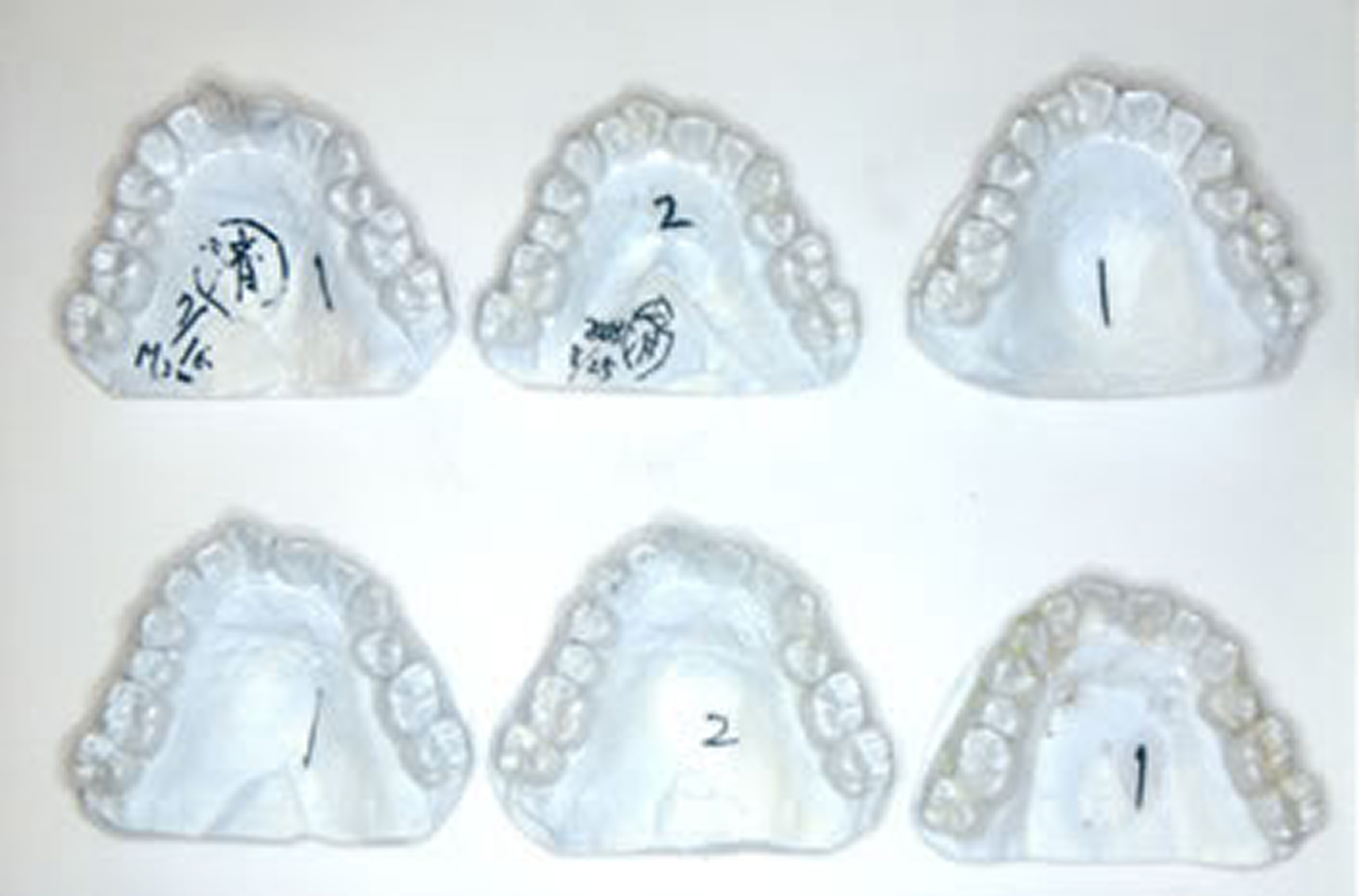 マウスピース矯正