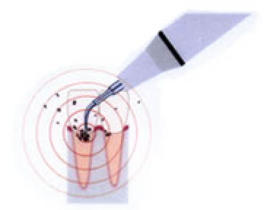 プロフェッショナルケア