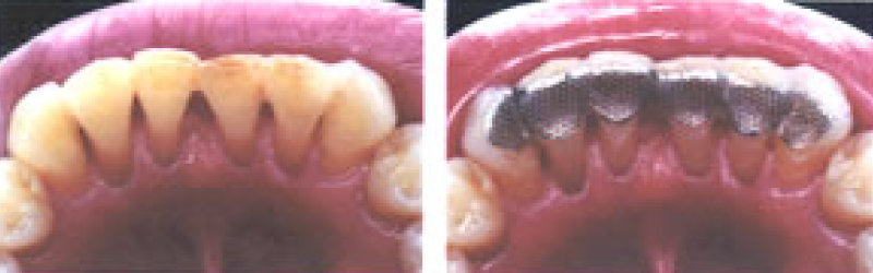 その他（固定、外科処置など）