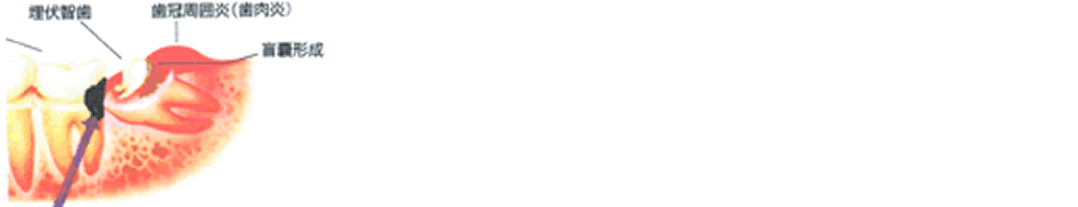 症状・状況による時