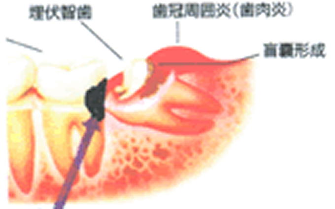 症状・状況による時