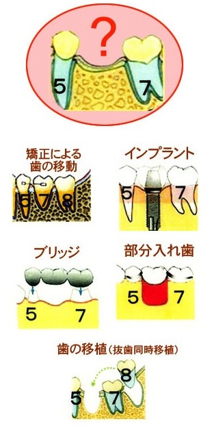 あなたはどの治療を選択しますか?