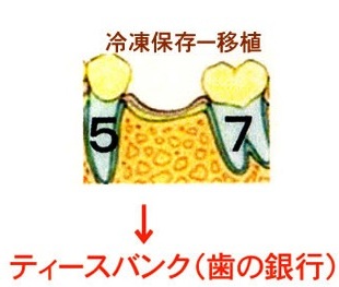 あなたはどの治療を選択しますか?