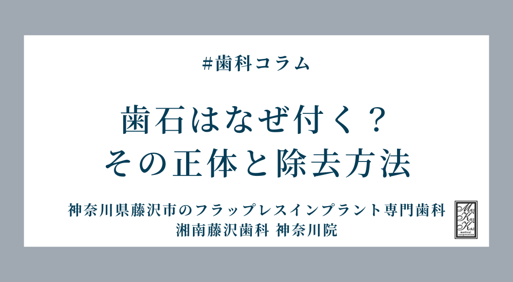 歯石はなぜ付く?その正体と除去方法